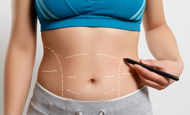Why You Should Get a Tummy Tuck 